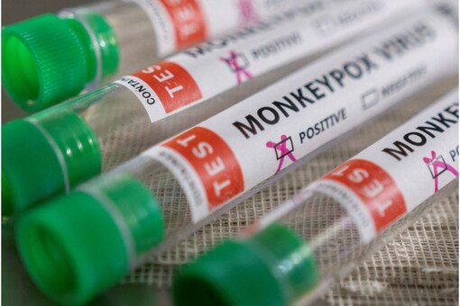 Monkeypox cases have been reported from Britain, Italy, Portugal, Spain, Canada and the US, among others. (File photo/Reuters)