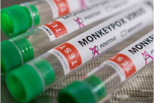 Monkeypox cases have been reported from Britain, Italy, Portugal, Spain, Canada and the US, among others. (File photo/Reuters) Monkeypox cases have been reported from Britain, Italy, Portugal, Spain, Canada and the US, among others. (File photo/Reuters)