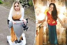 This Polish Woman hasn't Sit for 30 Years due to Rare Medical Condition