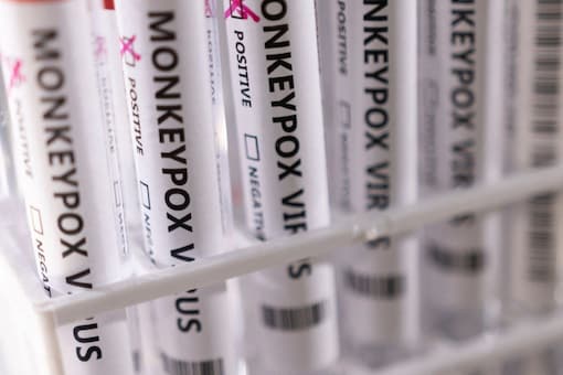 Test tubes labelled monkeypox virus positive. (Image: REUTERS/Dado Ruvic/Illustration)