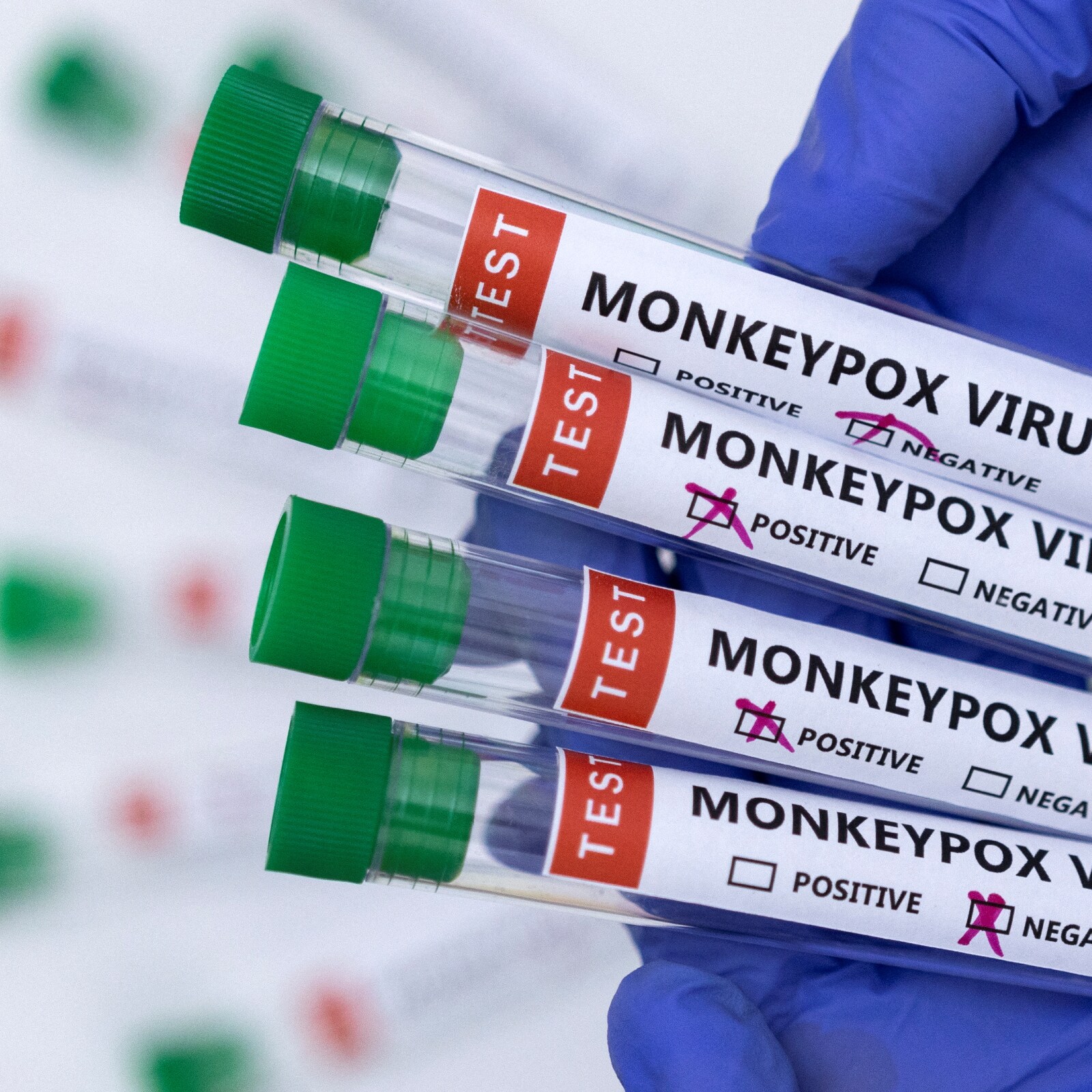 Explained: How fast does monkeypox spread and should India worry?