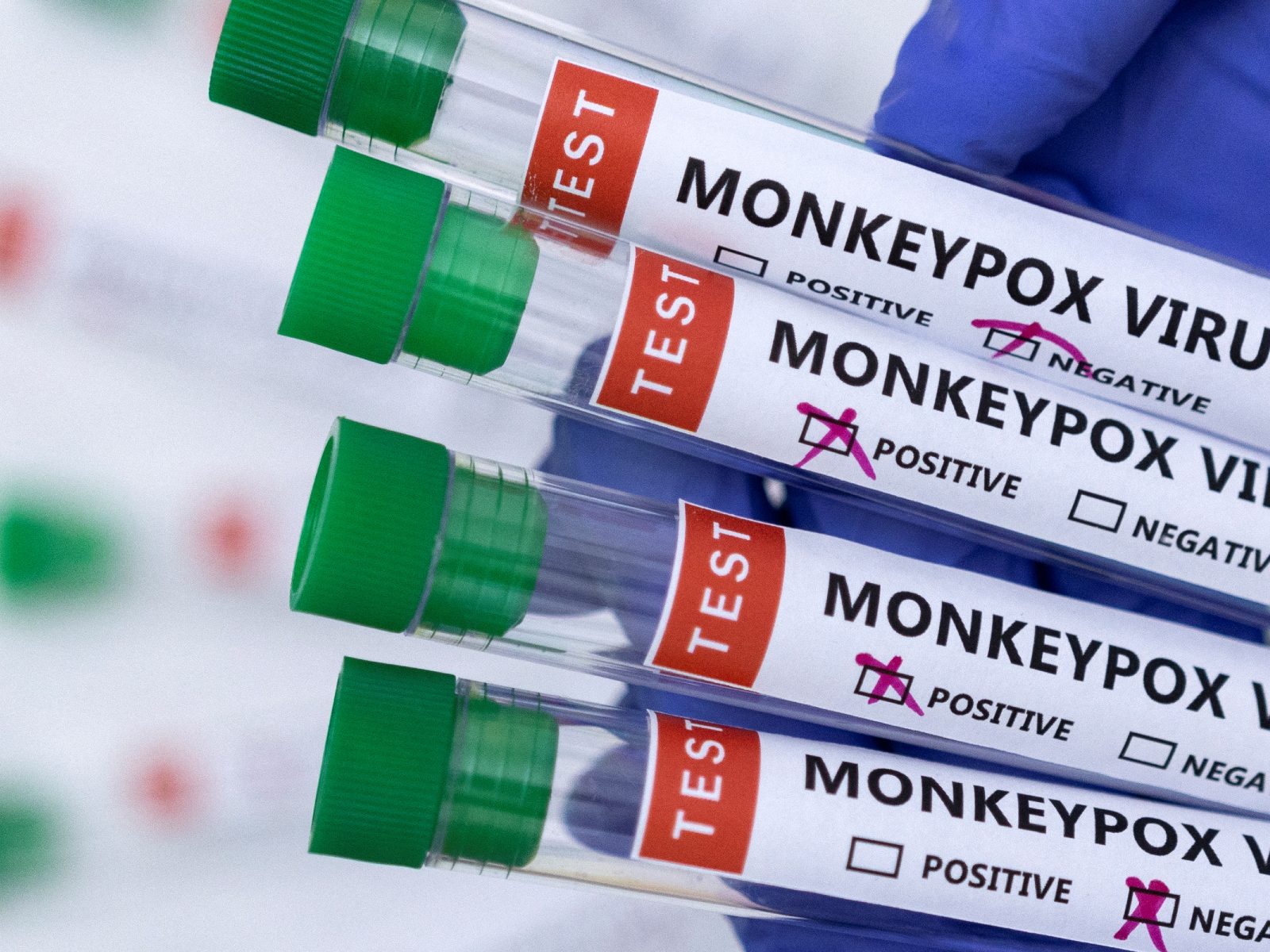 The World Health Organization Plans to Rename Monkeypox To Avoid Stigma, Racist Connotations.