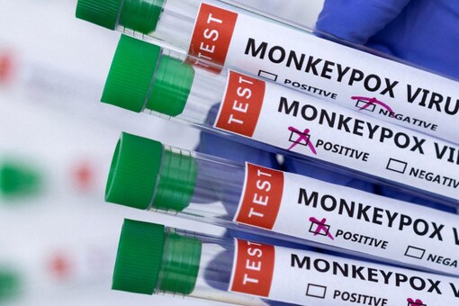 So far, 98% of cases outside the countries in Africa where the virus is endemic have been reported in men who have sex with men, the WHO said. (Photo: Reuters / File) So far, 98% of cases outside the countries in Africa where the virus is endemic have been reported in men who have sex with men, the WHO said. (Photo: Reuters / File)