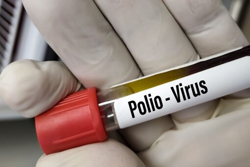 A person living in New York's Rockland County has tested positive for polio (Image: Shutterstock)