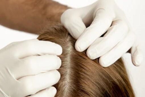 Tips and DIY Scrubs to Have a Healthy Scalp Tips and DIY Scrubs to Have a Healthy Scalp