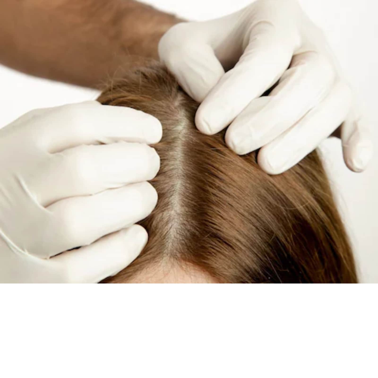 Trending news You also have pain in the roots of your hair so follow  these tips to get relief  Hindustan News Hub