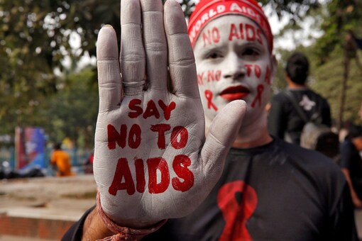 About 1 in 5 people in Botswana live with HIV -- one of the highest rates in the world -- according to UNAIDS. (Image for representation: REUTERS/Rupak De Chowdhuri)