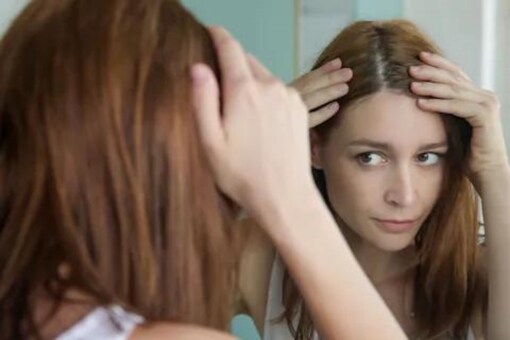 4 Natural Remedies To Reduce Hair Fall 4 Natural Remedies To Reduce Hair Fall