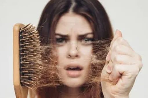 Could Stress, Anxiety, and Depression Be To Blame for Your Hair Loss?