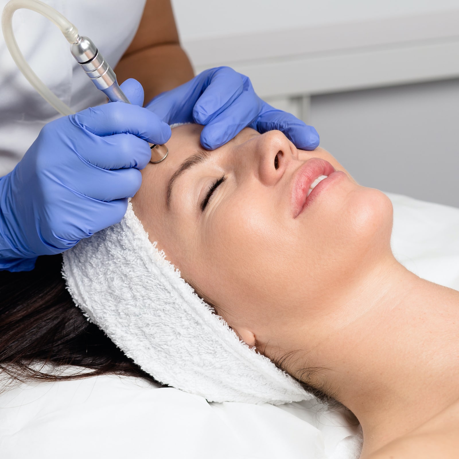 Microdermabrasion