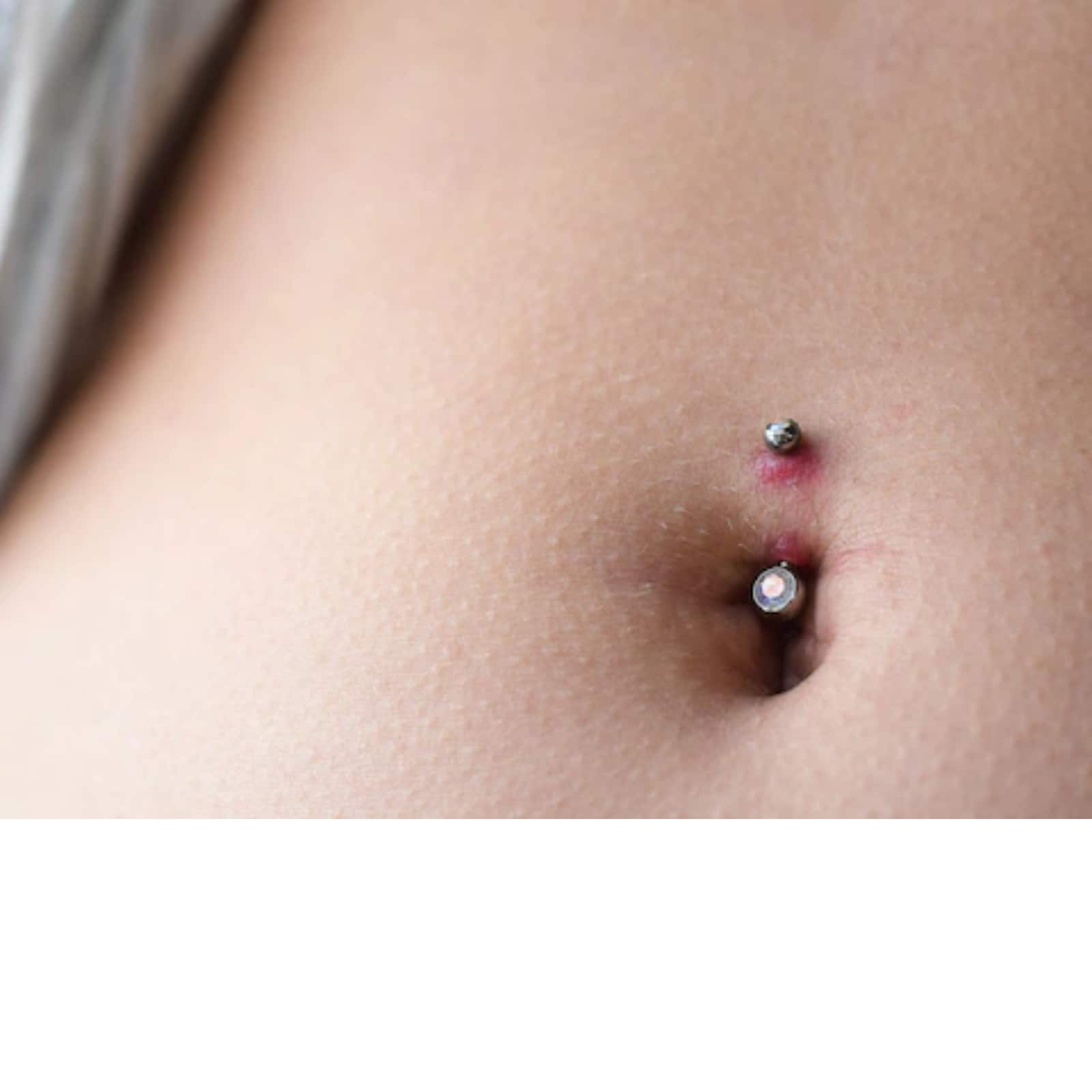 Causes Belly Button Infection? to Cure it