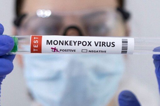 ʹͧԴҡ Monkeypox  (Ҿ: REUTERS/Dado Ruvic/ҾСͺ)