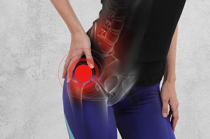 Hip Pain Relief - Nonsurgical Treatment Options