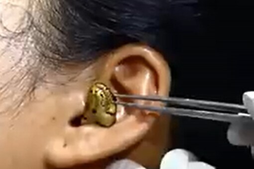 WATCH: Spooky Footage of Snake Stuck Inside Woman's Ear Shocks The ...
