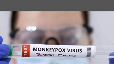 Monkeypox May Also Have Neurological and Psychiatric Effects, Says ...