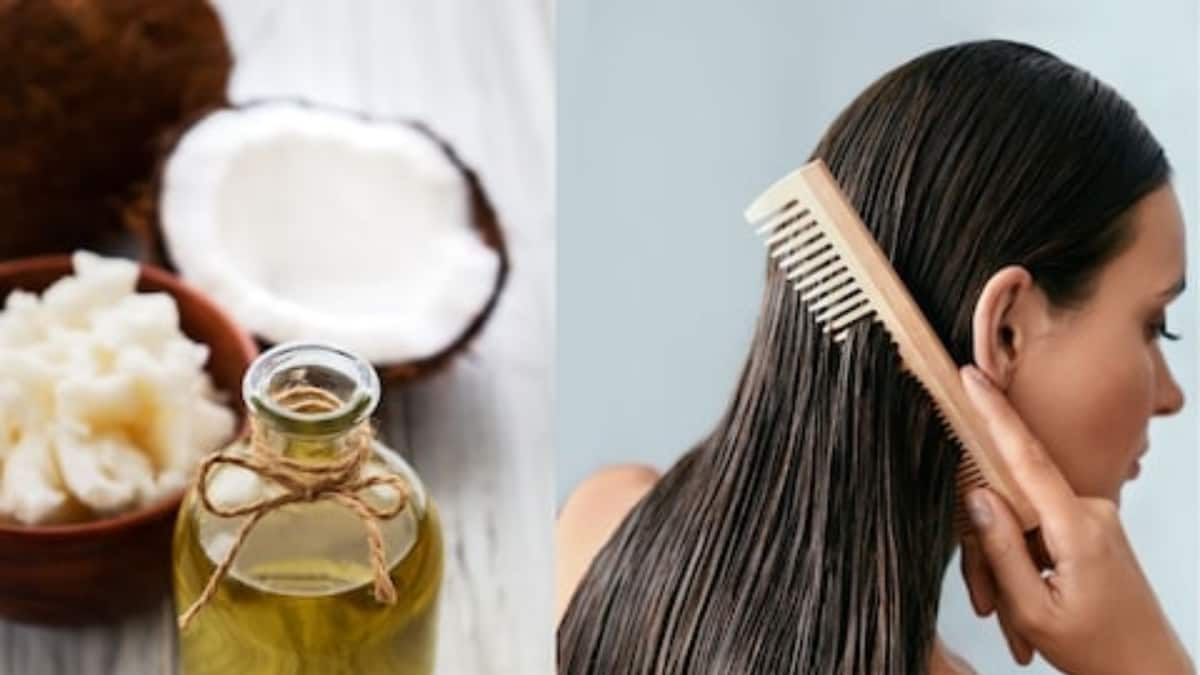 5 Ways You Can Make Use of Coconut Oil to Get Rid of Dandruff