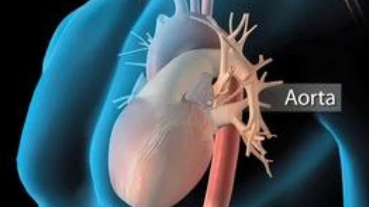 aortic-aneurysm-know-about-the-disease-often-mistaken-for-heart-attack