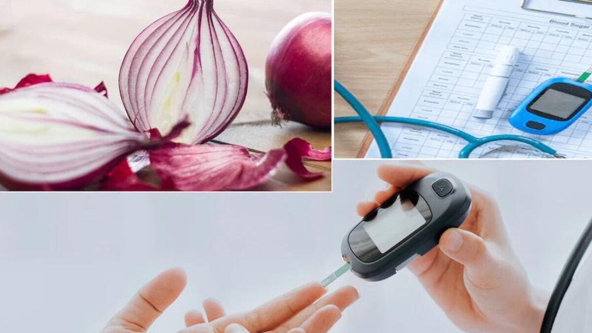 Onion Extract With Metformin Can Significantly Lower Blood Sugar Levels
