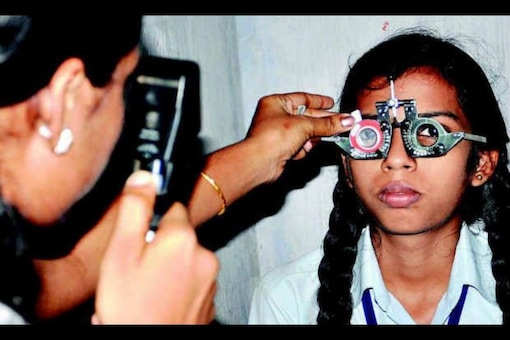 Most cases of paediatric cataract, ophthalmologists said, get picked up during routine eye screening of children or when parents notice a white glow in their eyes. (PTI image for representation)