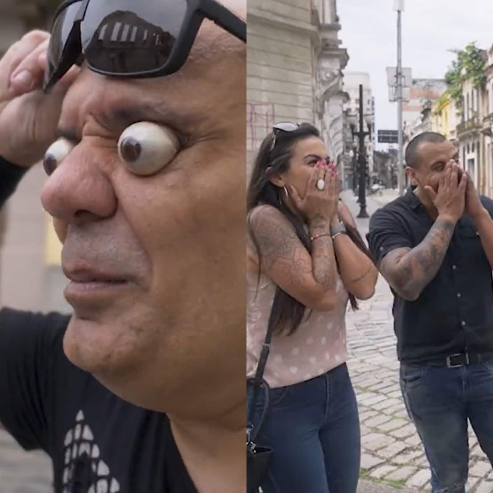 Man breaks world record for farthest eyeball pop