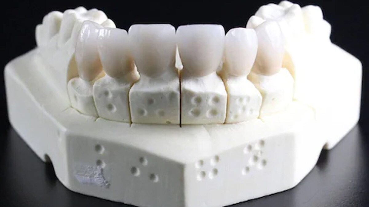 48YearOld Dies After Accidentally Swallowing, Choking On Her Dentures