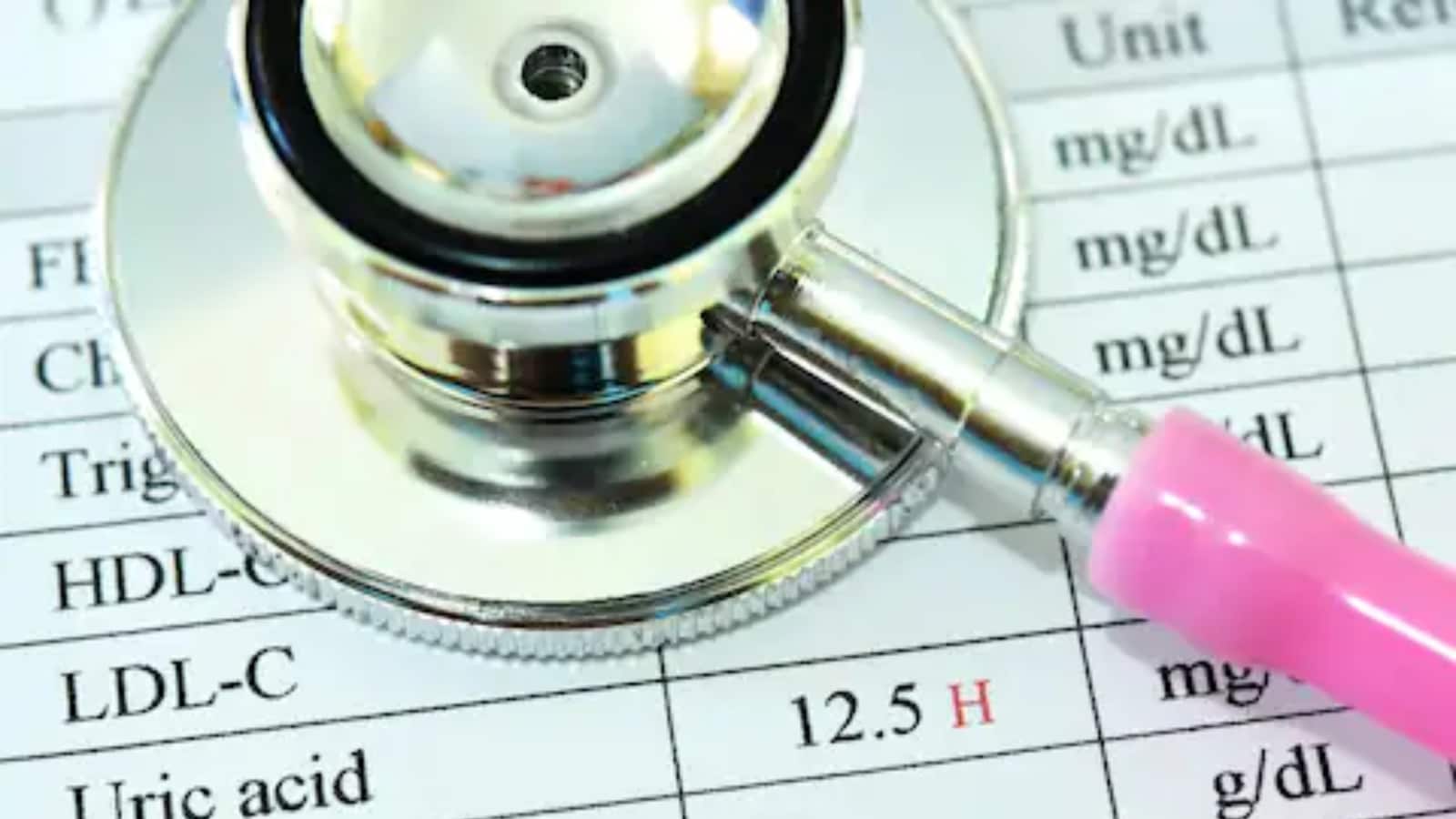 High Levels Of Uric Acid Know How Does It Impact Your Health