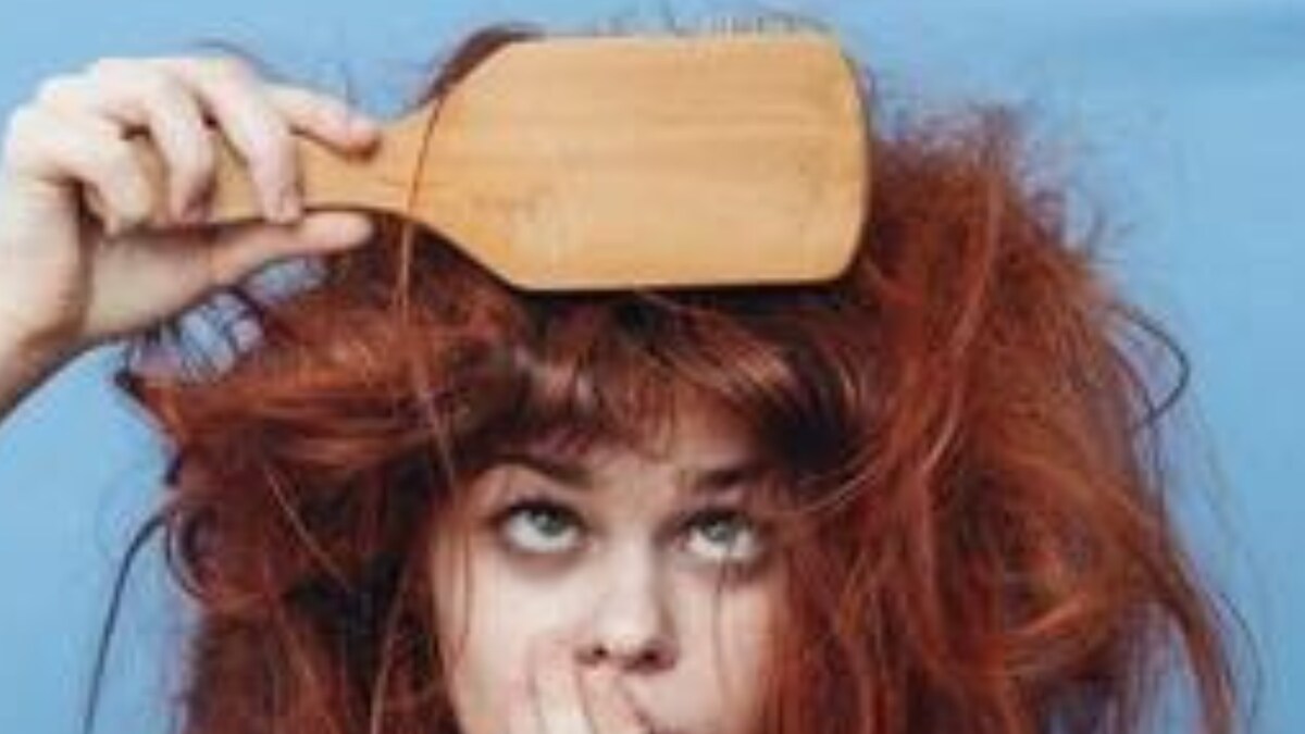 Everything You Need To Know About Hair Syndrome (UHS) News18