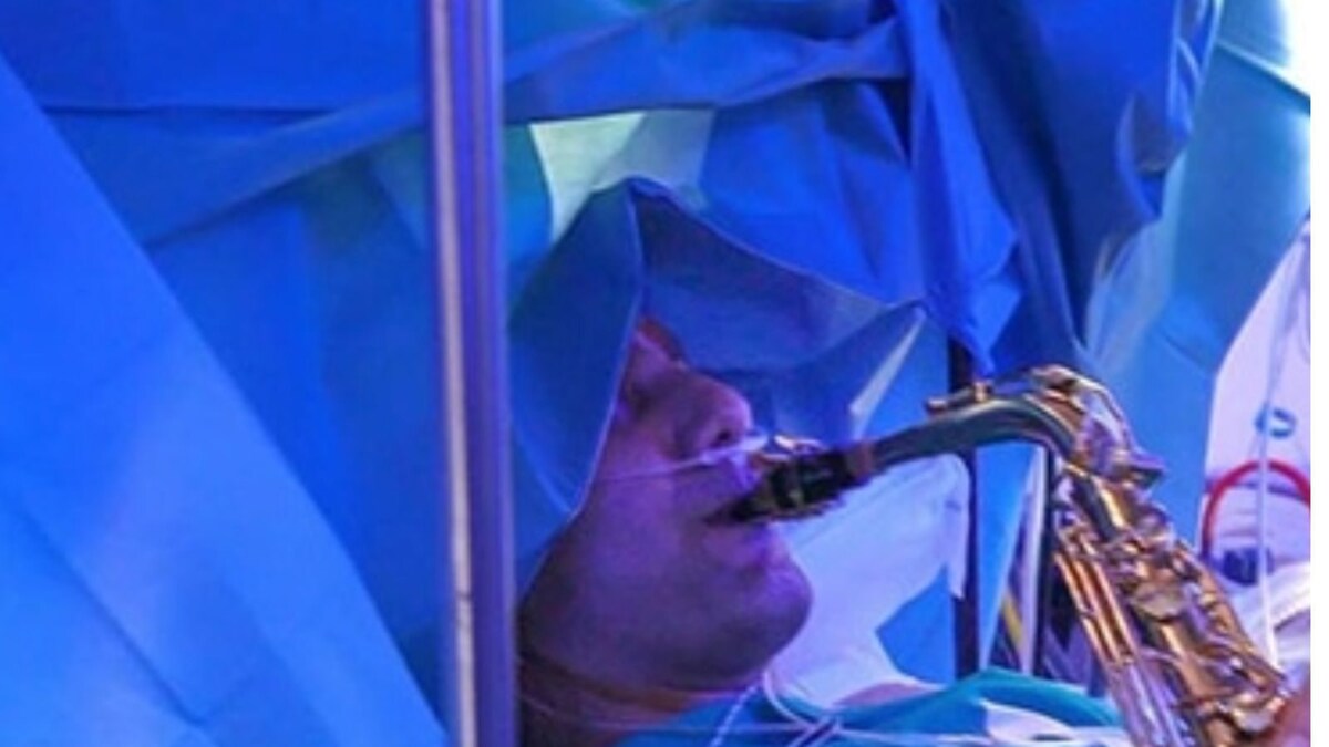 Massively Tailored Surgery Man Plays His Saxophone Through 9 Hour Complex Surgery News18 