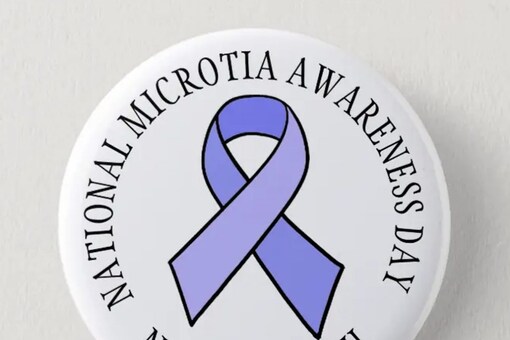 National Microtia Awareness Day 2022: All the Facts You Need ...