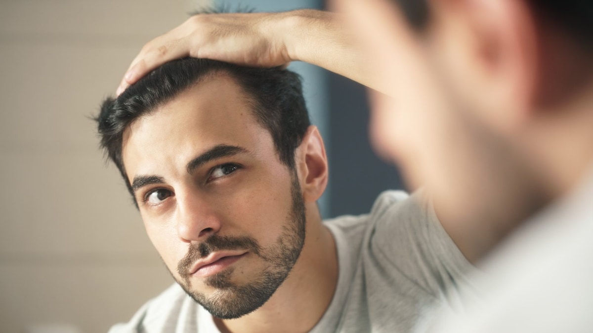 How To Prepare And Plan If You Want To Opt For A Hair Restoration Procedure