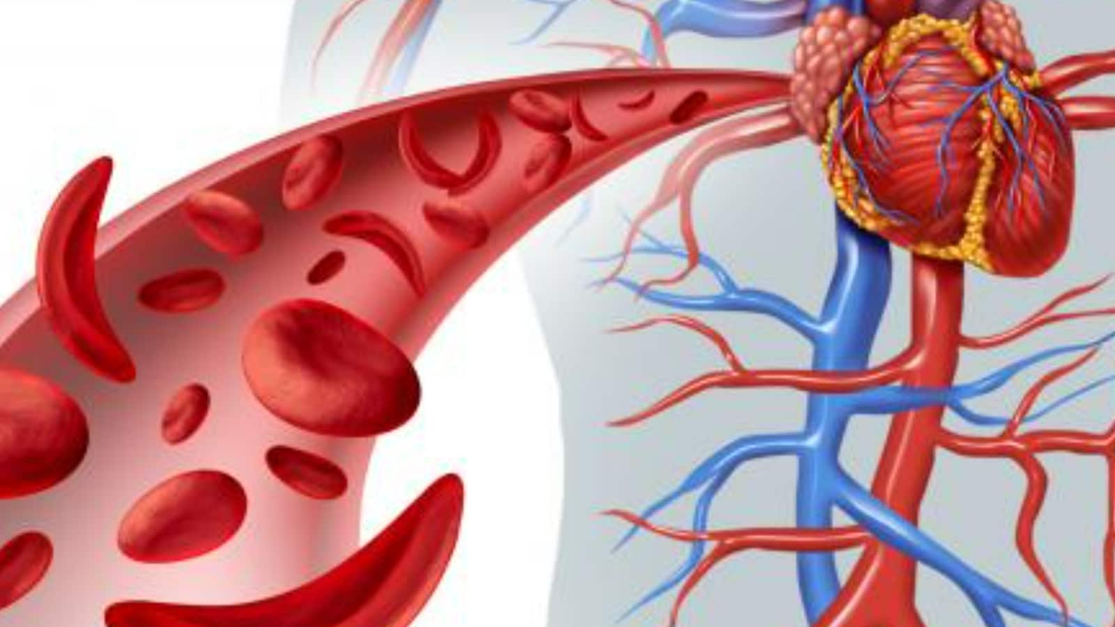 Govt Set to Draw First Blood in Battle to Beat Sickle Cell Anaemia by Screening 7 Cr People in Next 3.5 Years