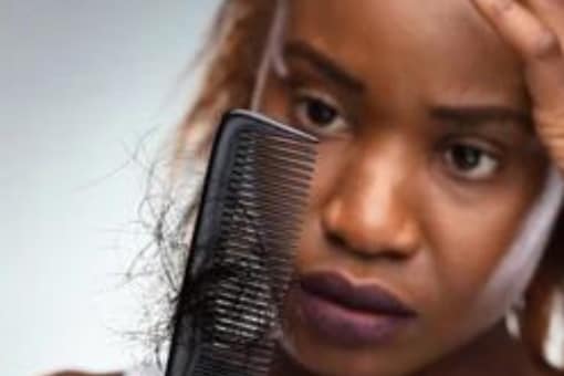 Tips And Tricks To Manage Excessive Hair Fall