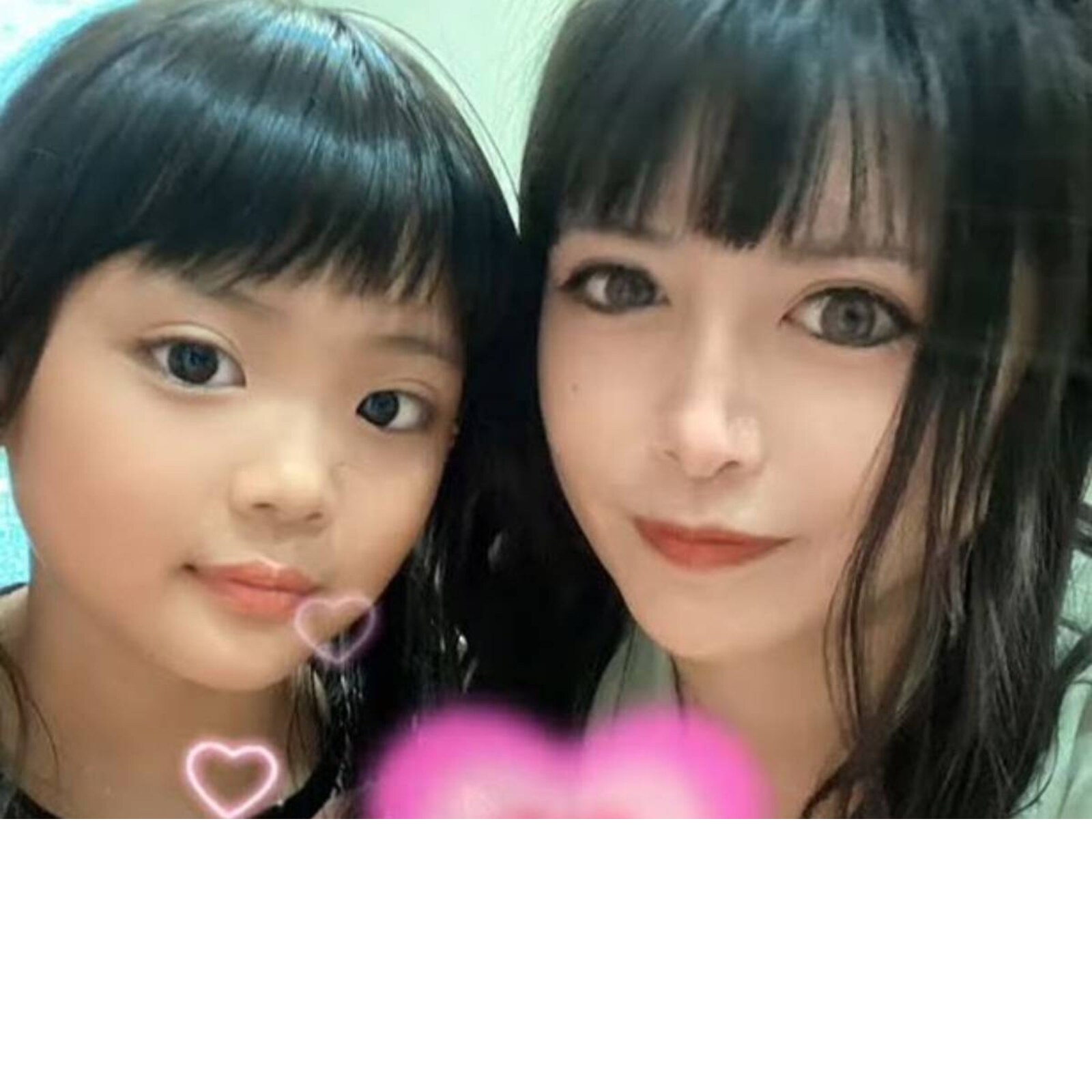 Plastic Surgery Clinic Korea Experience A More Beautiful You 3d Contour Cel...