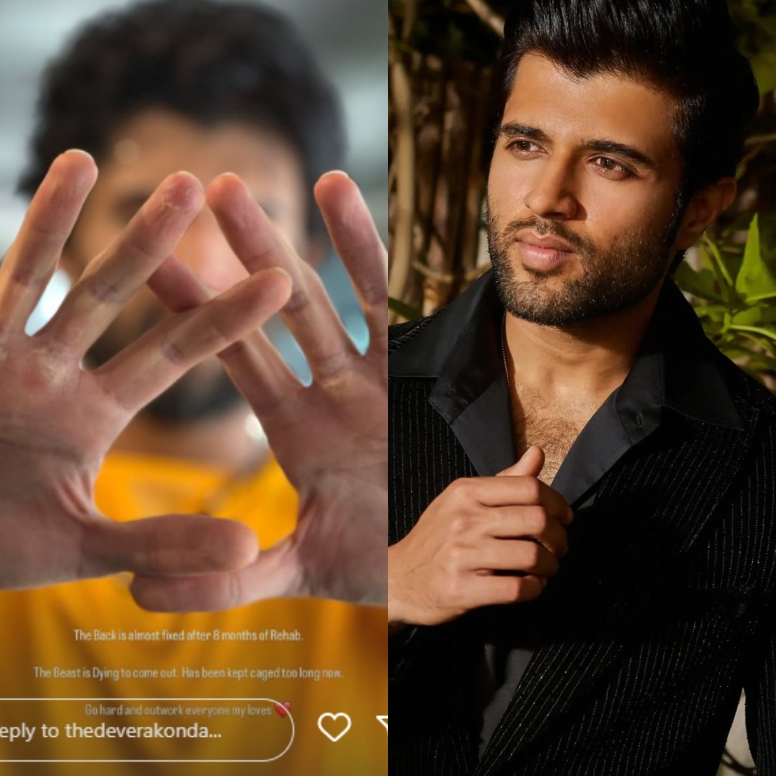 Vijay Deverakonda Recovers from Serious Injury After 8 Months, Says ‘The Beast Is Dying…’