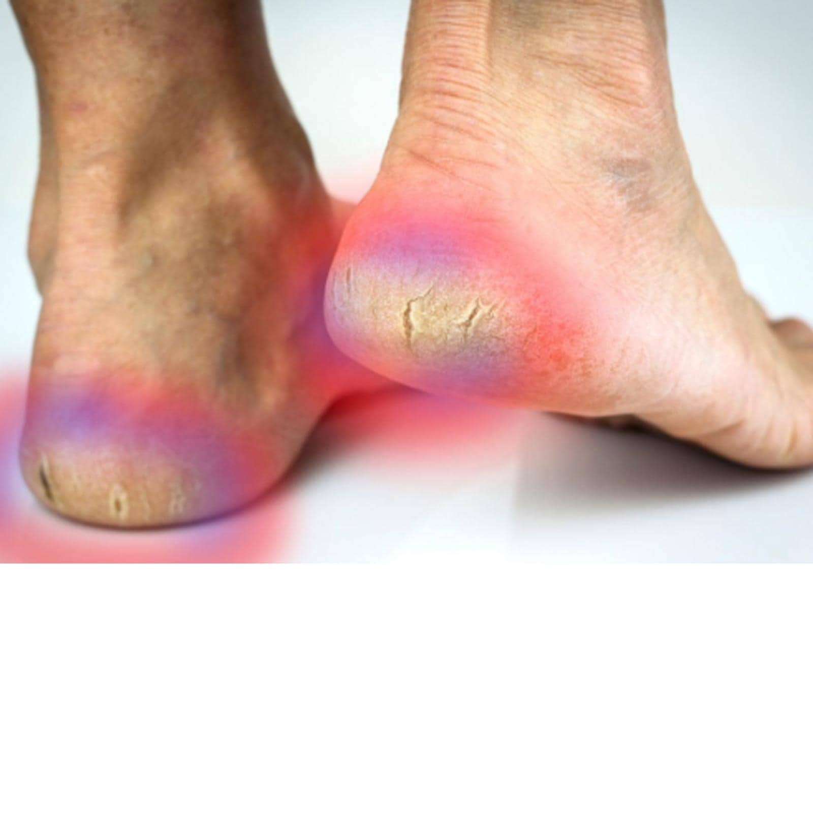 Gel Socks Heel Pain Relief Moisturising Padded Cracked Heels Comfort (One  Pair) | eBay