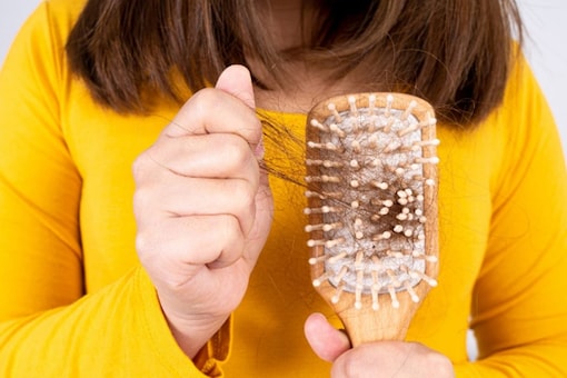 Did You Know Sweating Can Cause Hair Fall? Did You Know Sweating Can Cause Hair Fall?
