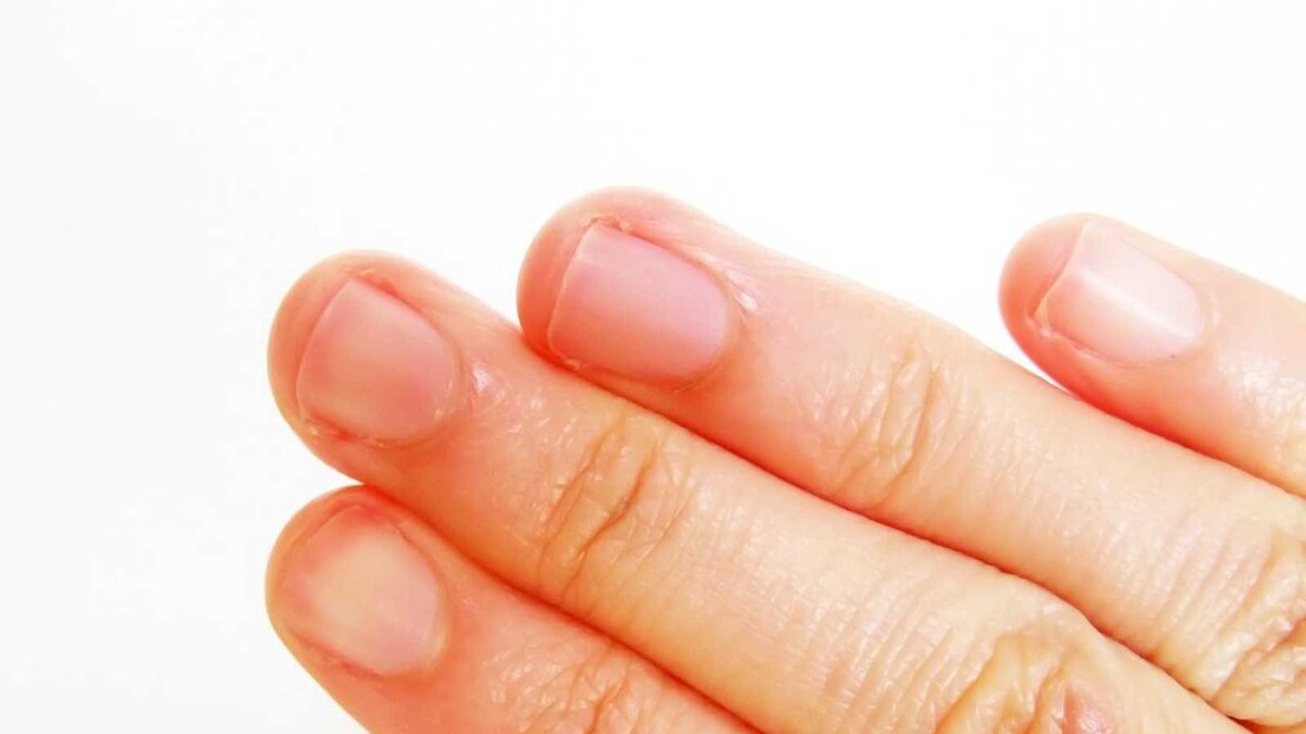 Are Your Fingertips Peeling? Know Home Remedies To Treat It News18