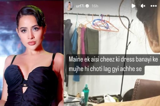 Urfi Javed shares a picture revealing how she was badly bruised with one of her recent outfit. (Photo: Instagram) 