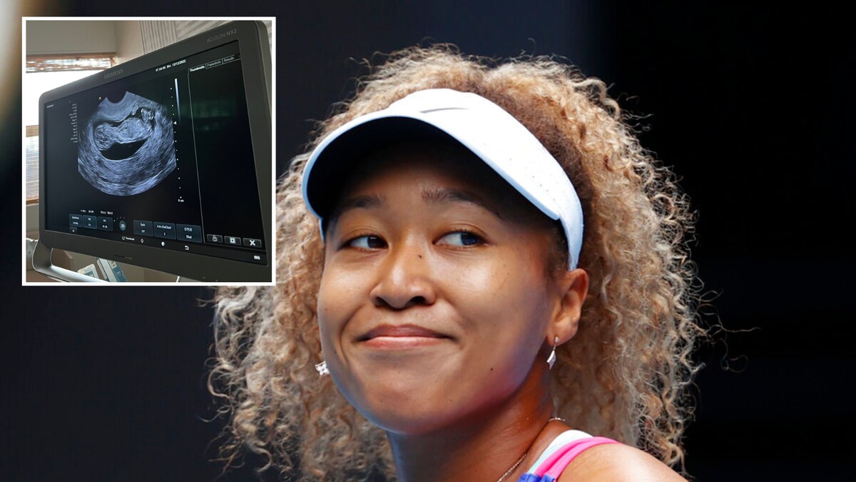 Congratulations! Tennis World Reacts to News of Naomi Osaka's Pregnancy