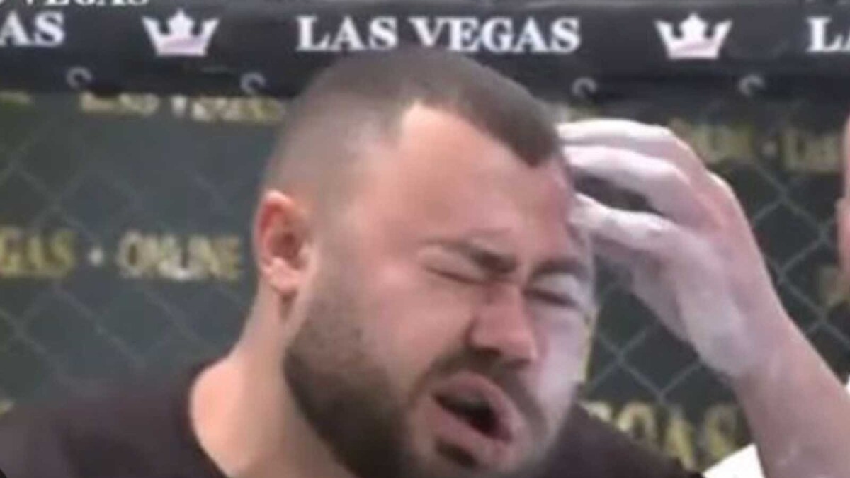 Man Takes Part In Slapping Competition, Left With Swollen And