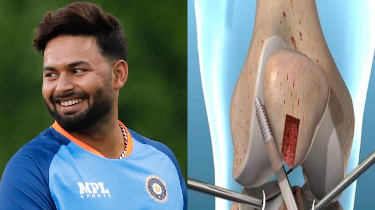 Rishabh Pant to Undergo Ligament Tear Surgery; Know About Its Procedure and Recovery Time