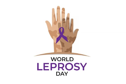 World Leprosy Day: Leprosy is hard to catch. According to the United States Centers for Disease Control and Prevention (CDC) 95 percent of adults cannot catch it. (Image: Shutterstock)