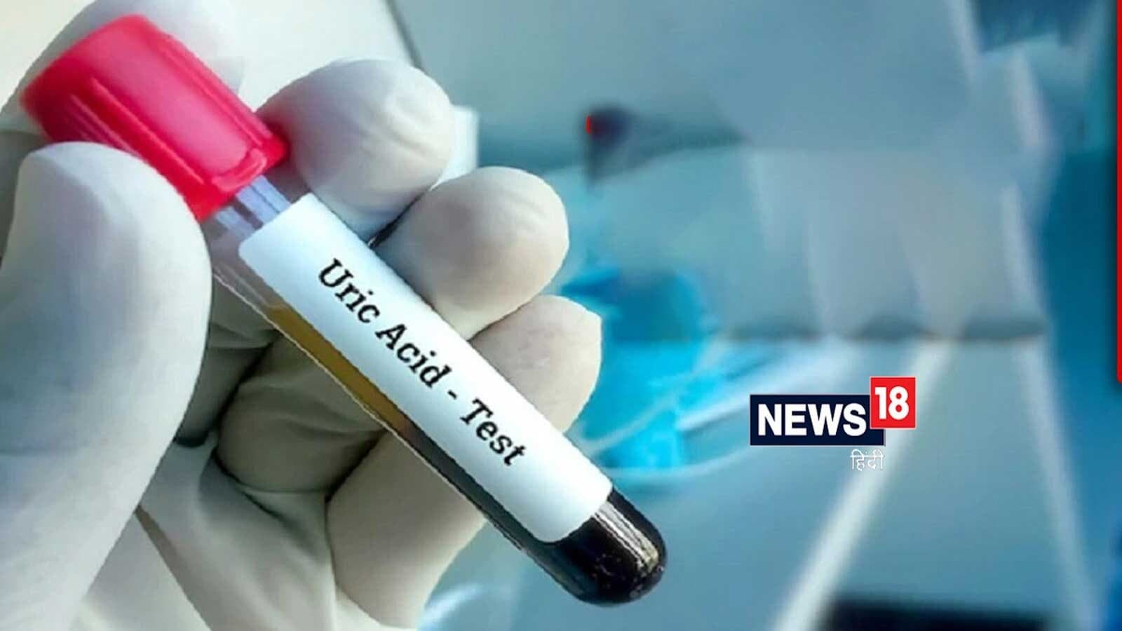 Foods To Avoid If You Have High Uric Acid foods-to-avoid-if-you-have-high-uric-acid