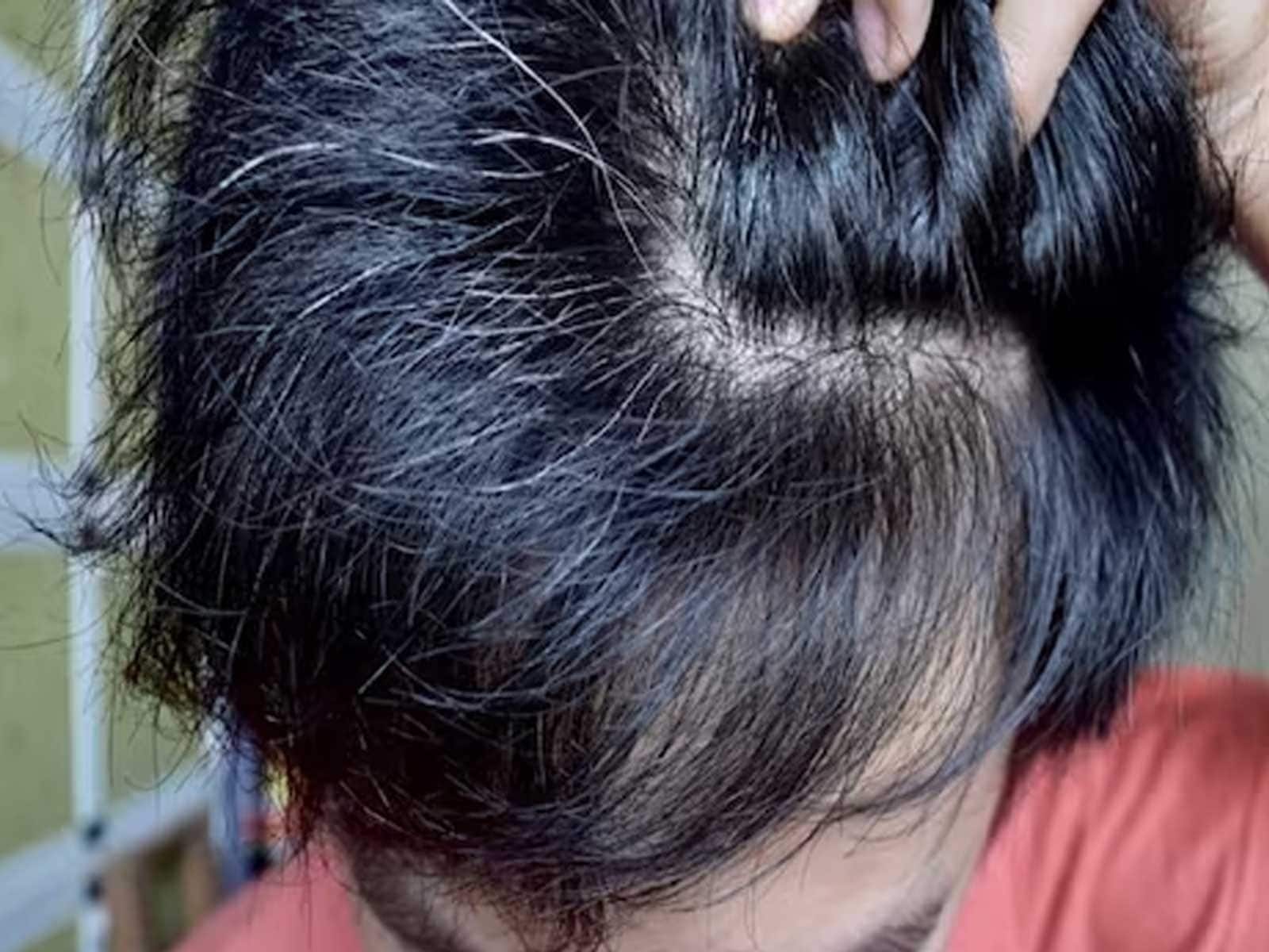 Can gray gair actually be reversed? This @maryruthorganics vitamin has... | Grey  Hair Reversal | TikTok
