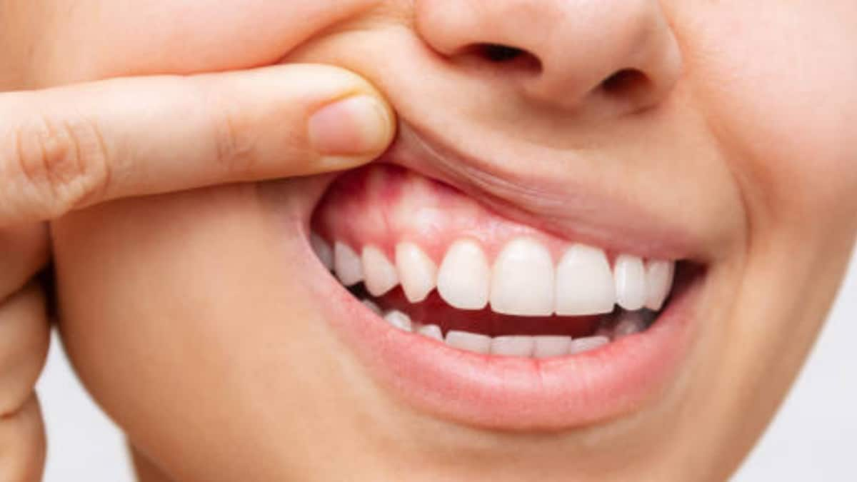 Here Is What You Should Be Doing If You Want Healthy Gums