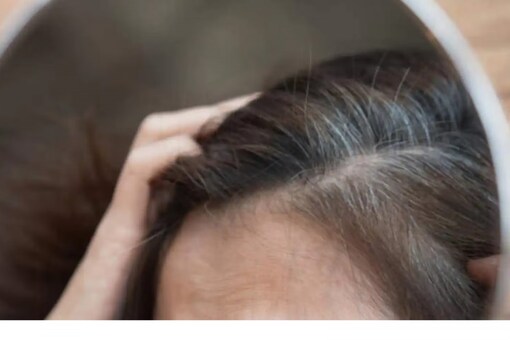 The doctor suggested that the problem of hair fall has been increasing rapidly nowadays.