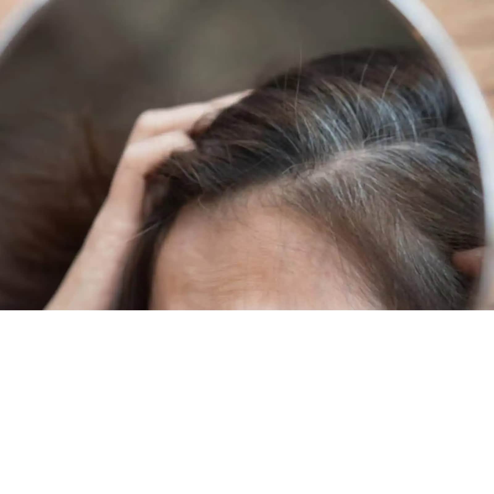 How to Get Rid of Dandruff and Hair Fall   Mamaearth
