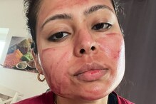 'The Ordinary Exfoliant': Woman's Prank About Using Blood For Skin Care Has Men Baffled 'The Ordinary Exfoliant': Woman's Prank About Using Blood For Skin Care Has Men Baffled