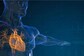 Heart Attack: What Causes It? Your Gender May Play A Role In It As Well