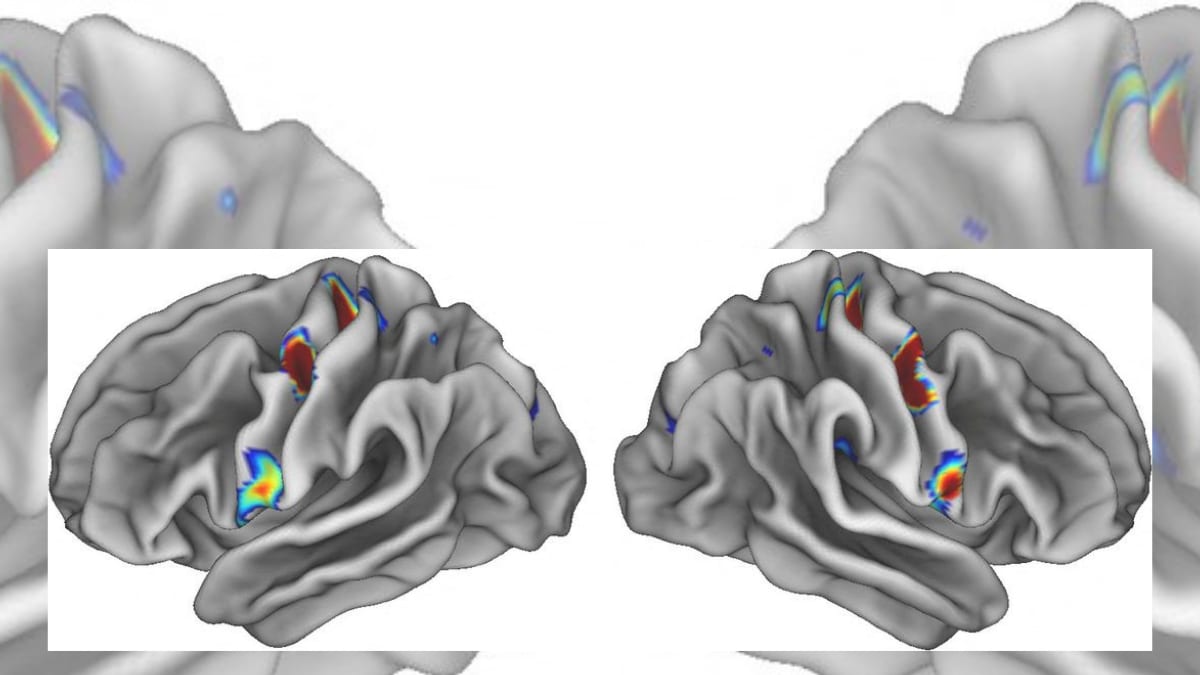 Scientists Identify Mind-body Nexus in Human Brain - Vimarsana News